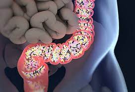 Clostridioides difficile (formerly clostridium difficile) colitis results from a disturbance of the normal bacterial flora of the colon, colonization by c difficile, and the release of toxins that cause mucosal. Is C Diff Clostridium Difficile Contagious