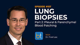 BioSentry Plug vs Blood Patching: Preventing Pneumothorax After Lung Biopsy