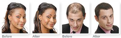 Xfusion Keratin Hair Fibers Light Brown 12g Beauty Stop Online
