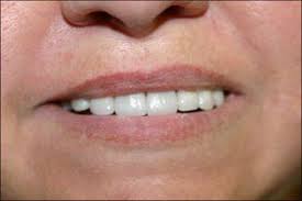 Patient Testimonials