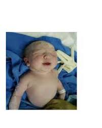 How To Deliver A Baby At Home Emergency Situation Delivering A Baby Emergency Prepardness Emergency