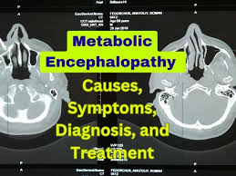 Encephalopathy And Other Brain Diseases