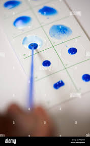 Image result for Monospot