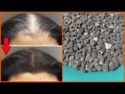 هذي هي الوصفة اللي جداتنا وامهاتنا كانو كيعالجو بها تساقط الشعر بلاكريمات من الصيدليات Youtube Hair Care Hair Growth Hair
