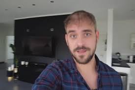 Schauspieler Marc Barthel zeigt das Ergebnis seiner 2. Haartransplantation