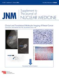 To help you prepare, here's a look at what to expect. 18f Fdg Pet Ct For Staging And Restaging Of Breast Cancer Journal Of Nuclear Medicine