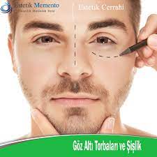 Goz Alti Torbalari Sislikleri Yuz Estetiginin Guzelligini Etkilemesin By Estetik Memento Medium