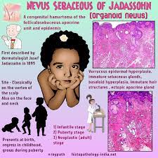They undergo a growth phase during puberty due to hormonal changes. Pathology Of Nevus Sebaceus Of Jadassohn Pathology Androgen Receptor Medicine Notes