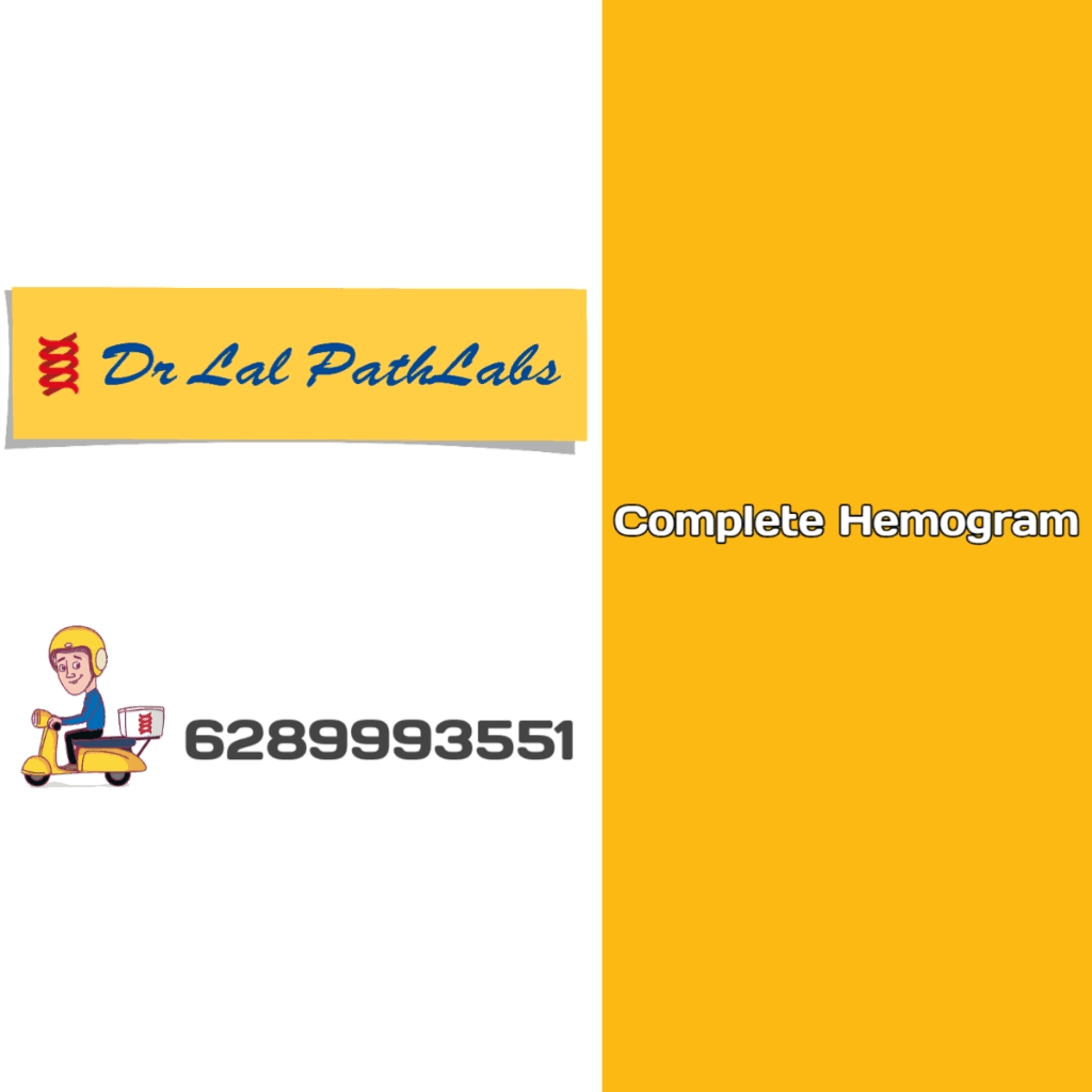 Complete HEMOGRAM test product image
