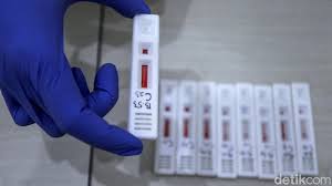 Check spelling or type a new query. Ada Layanan Rapid Test Rp 85 Ribu Di Stasiun Ka Apa Syaratnya