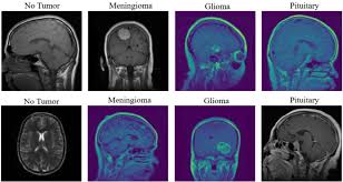 Image result for Primary Tumor Localization