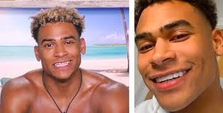 Jun 11, 2021 · katie price is planning to get full body liposuction, a brow and face lift and new teeth. Love Island The Islanders With The Most Shocking Teeth Transformations