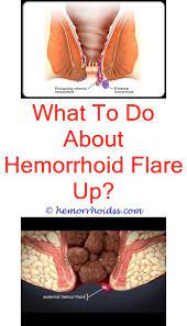How to use hemorrhoid suppositories. Can You Treat Hemorrhoids With Witch Hazel How Long Do Hemorrhoid Suppositories Take To Work H Hemorrhoid Remedies Bleeding Hemorrhoids Hemorrhoids Treatment