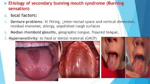 Oral Medicine Burning Mouth Syndrome