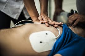 Image result for Defibrillation