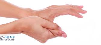 Main/ redirect nombretomado creating red links in 2 articles.abandoning 339 … Souffrez Vous Du Diabete Surveillez Vos Mains Dr Brutus