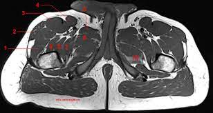 The splenius muscles both originate from the. Mri Of The Thigh Detailed Anatomy Superior Part W Radiology