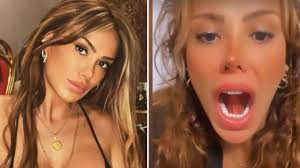 Ceyda Ersoy öpüşürken kopan dilini diktirdi - Kendine Demokrat Olmayan  Haberler