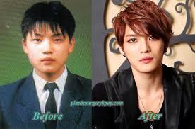 Best Kpop Plastic Surgery Allkpop Forums