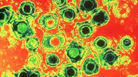A collection of the top 40 hsv wallpapers and backgrounds available for download for free. Herpes Simplex Virus Type 1 Hsv 1 Prevalence Triggers Everyday Health