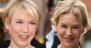 Renée zellweger recalls overhearing strangers say she was stupid for having plastic surgery. Renee Zellweger S Face Before And After Plastic Surgery