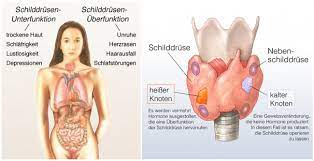 Kalter Knoten Ursachen Behandlung Vorbeugung Gesundpedia De