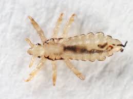 And what can i do to get rid of them?? Pictures Of Head Lice On Hair