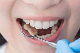 Check spelling or type a new query. Wisdom Teeth Removal For Teens In Dallas Children S Dental Ortho
