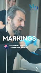 We know very well that our patients wonder about the marking process