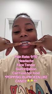 Yall I cant with this shitttt😭😭 #bracespain #irritated #day2 #bracestips  #bracestok #mouthpain #braceshacks #fyppp #teamwork