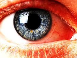 Patients with basal cell carcinomas most commonly notice a reddish nodule slowly forming on their eyelid. 12 Scary Things Your Eyes Say About Your Health Cbs News