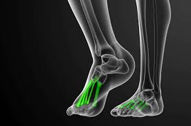 Image result for Metatarsal