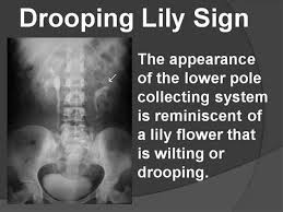 Pin By Angela A On Xray Critique Nuclear Medicine Medical Mnemonics Radiology