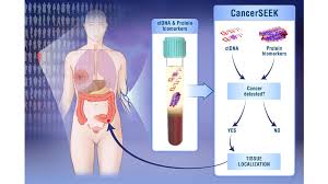 While no blood test can diagnose cancer, some blood tests can aid in the diagnosis of cancer. Single Blood Test Screens For Eight Cancer Types