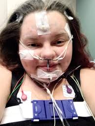 Do sleep studies help with fibromyalgia diagnosis?