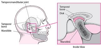 Maybe you would like to learn more about one of these? Temporomandibular Disorders Mouth And Dental Disorders Merck Manuals Consumer Version