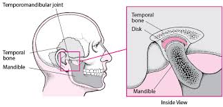 How serious is temporomandibular joint disorder? Temporomandibular Disorders Mouth And Dental Disorders Msd Manual Consumer Version