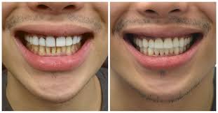 Some plans require a copay for preventive services while others cover. Family Dentistry Near Me Emergency Dental Care Services In Manhattan Affordable Dentist Affordable Dental Implants Dentist Near Me