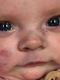 How you can help family of 2-month-old girl who died of a brain injury in  the tornado