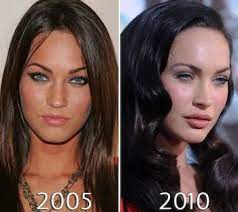 However, the before and after photos speak for themselves. Megan Fox Plastic Surgery