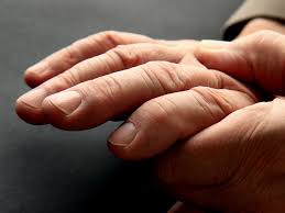 Swollen Fingers: 11 Causes and When to Call the Doctor ...