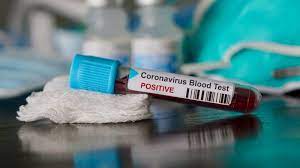 A viral test tells you if you currently have an infection with. New Rapid Test Kit To Detect Covid 19 Soon Available In Eu Euractiv Com