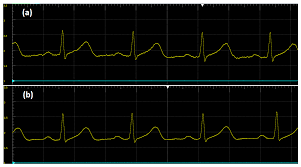 Adoptions for pocket pets, listed in the other category below, are $20. Sensors Free Full Text Fabricating A Portable Ecg Device Using Ad823x Analog Front End Microchips And Open Source Development Validation Html