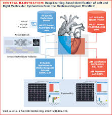 Image result for Electrocardiogram Validity