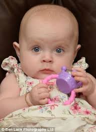 Parents forced to turn to payday loans to fund baby daughter's head  deformation treatment after NHS refuse to help