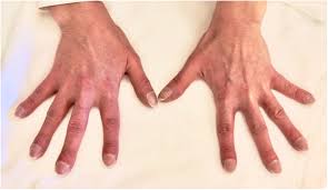 Image result for Digital Clubbing