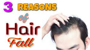 Here's what you need to know about. 3 Reasons Of Hair Fall Why Men Are Bald Factors Of Hair Loss And Hair Thinning Youtube