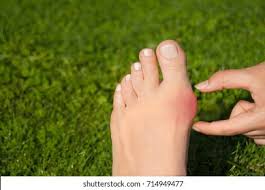 Foot Anatomy Bone: Over 9,821 Royalty-Free Licensable Stock Photos