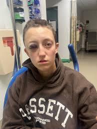 Fundraiser by Jenna Escobedo : Aid Emmett After Skull Fracture