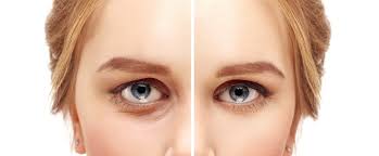 The food sources which are high in calories should make your face fat and looks puffy. Thomassen Plastic Surgery 9 Ways Your Face Changes As You Age
